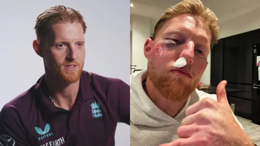 Career almost over! Ben Stokes reveals horrific injury, confirms comeback