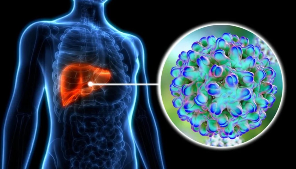 New drug in clinical trials could finally cure hepatitis E
