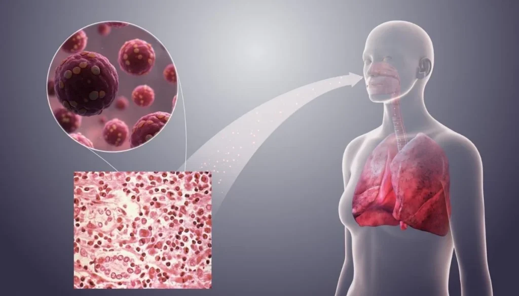 Here's how hantavirus spreads between humans