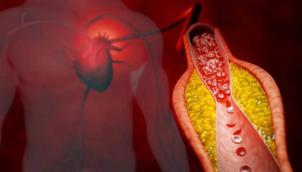 Scientists unveil breakthrough treatment that reduces bad cholesterol by 50%